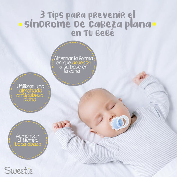 4 tips para prevenir el síndome de cabeza plana