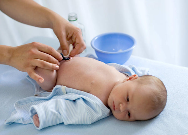 5 tips para el Cuidado del cordón umbilical de tu bebé